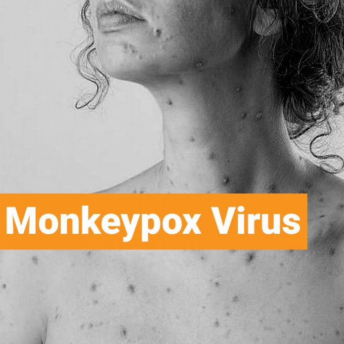 Monkeypox virus Prevention